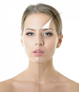 lipofilling facial tunisie