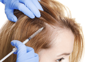 mesotherapie-cheveux